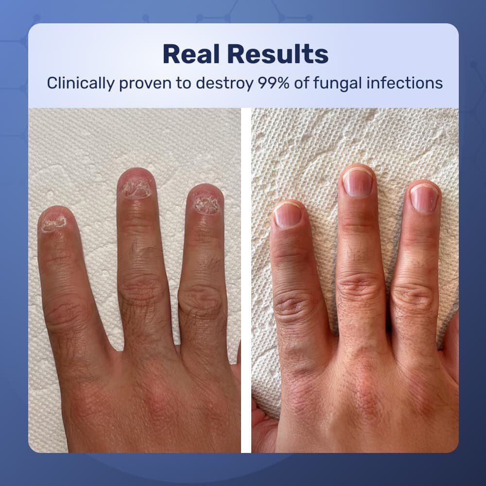 WellNail image
